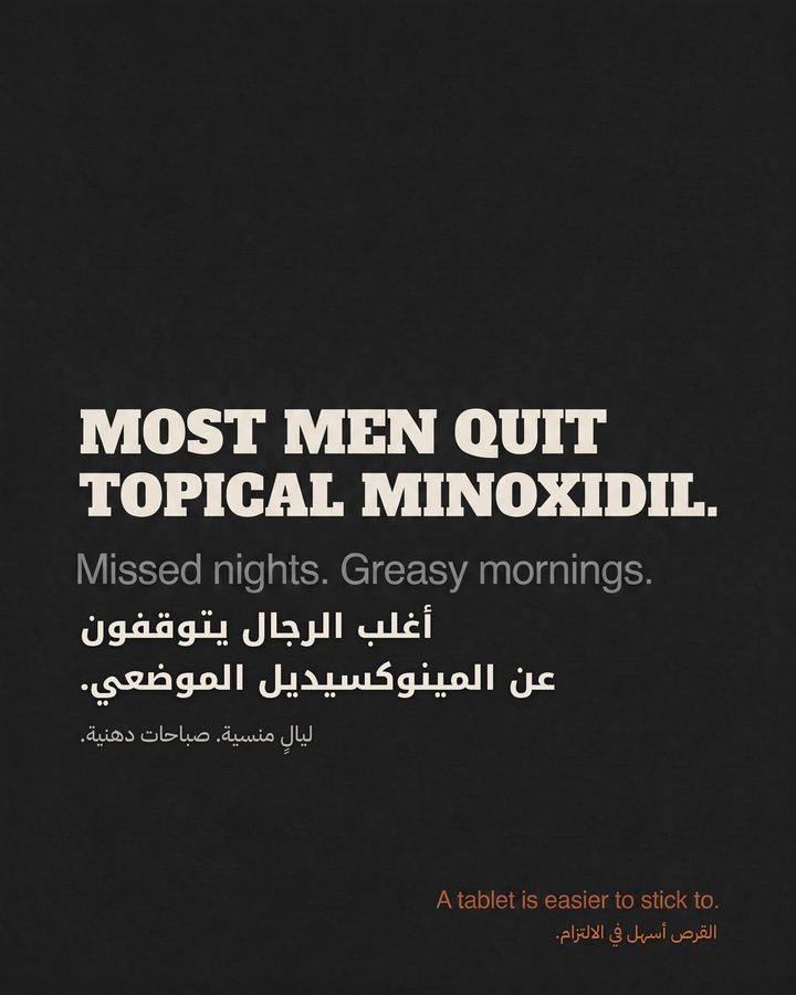 Most men quit topical minoxidil. 86% had stopped in one 400-patient study. A tablet is easier to stick to.